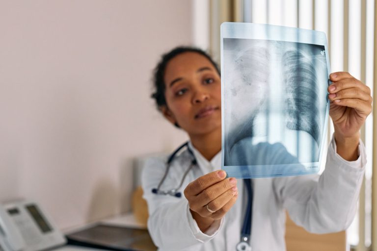 OMS inclui inteligência artificial em programa de pré-qualificação para tuberculose Profissional de saúde analisa uma radiografia de tórax exibida em um monitor médico.
